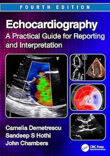 عکس Echocardiography: A Practical Guide for Reporting and Interpretation 4th Edition