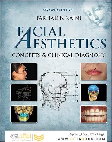 Facial Aesthetics: Concepts and Clinical Diagnosis