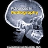 Advances in Radiography (New Developments in Medical Research)