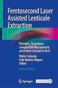 عکس Femtosecond Laser Assisted Lenticule Extraction: Principles, Techniques, Complication Management, and Future Concepts in KLEx Second Edition