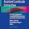 Femtosecond Laser Assisted Lenticule Extraction: Principles, Techniques, Complication Management, and Future Concepts in KLEx Second Edition