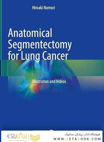 Anatomical Segmentectomy for Lung Cancer: Illustration and Videos