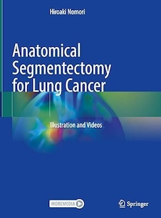 عکس Anatomical Segmentectomy for Lung Cancer: Illustration and Videos
