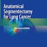 Anatomical Segmentectomy for Lung Cancer: Illustration and Videos