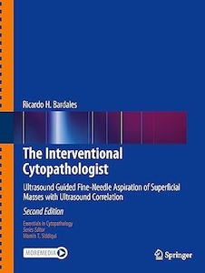 عکس The Interventional Cytopathologist: Ultrasound Guided Fine-Needle Aspiration of Superficial Masses with Ultrasound Correlation