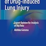 Analysis File of Drug-Induced Lung Injury: Expert Opinion for Analysis of Big Data