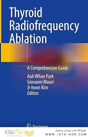 Thyroid Radiofrequency Ablation: A Comprehensive Guide