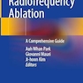 Thyroid Radiofrequency Ablation: A Comprehensive Guide