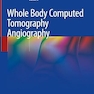 Whole Body Computed Tomography Angiography