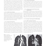 Whole Body Computed Tomography Angiography