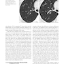 Whole Body Computed Tomography Angiography