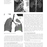 Whole Body Computed Tomography Angiography