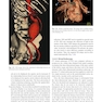 Whole Body Computed Tomography Angiography