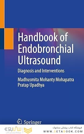 Handbook of Endobronchial Ultrasound: Diagnosis and Interventions