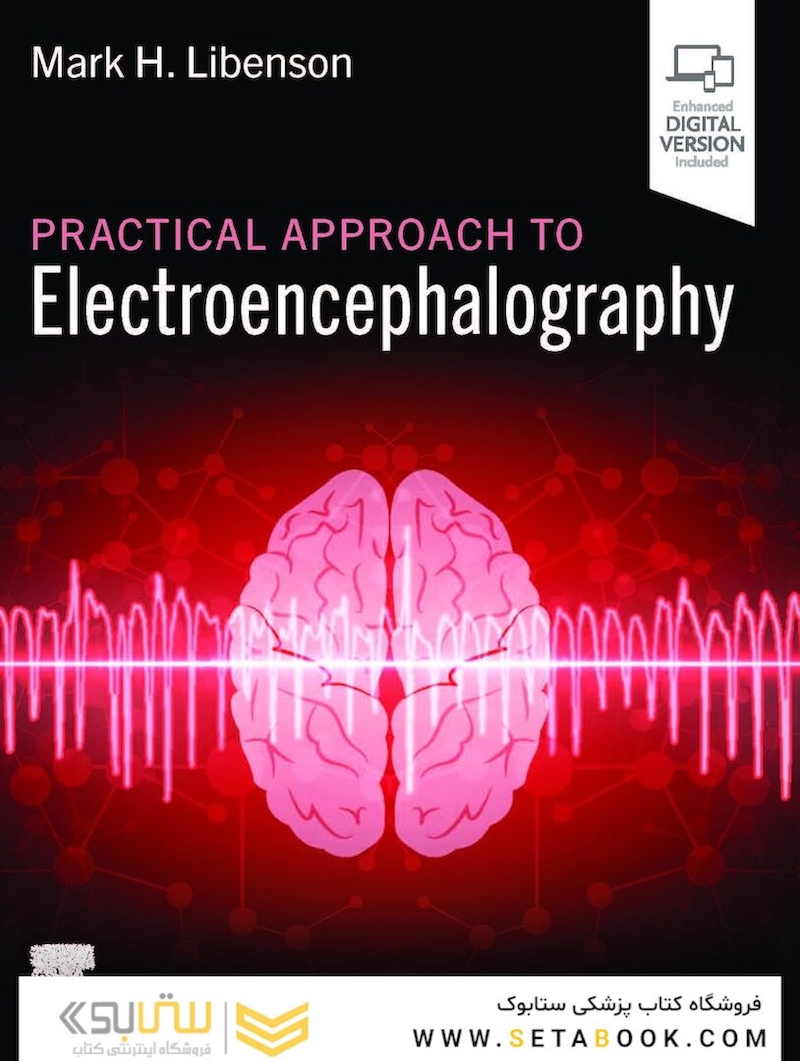 Practical Approach to Electroencephalography 2nd Edition 2025