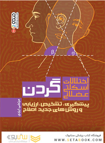 اختلالات اسکلتی عضلانی گردن