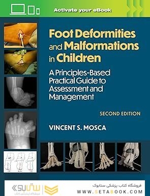 Foot Deformities and Malformations in Children: A Principles-Based, Practical Guide to Assessment and Management:Second Edition