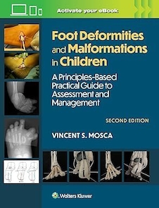 عکس Foot Deformities and Malformations in Children: A Principles-Based, Practical Guide to Assessment and Management:Second Edition