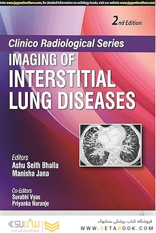 Clinico Radiological Series-Imaging of Interstitial Lung Diseases