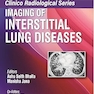 Clinico Radiological Series-Imaging of Interstitial Lung Diseases