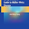 Comprehensive Guide to Müller-Weiss Disease