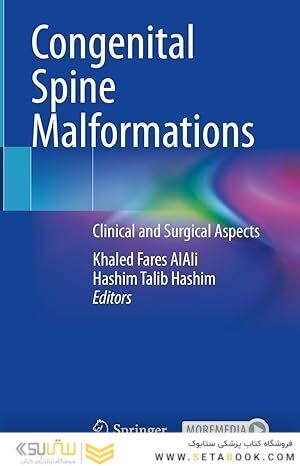 Congenital Spine Malformations: Clinical and Surgical Aspects