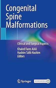 عکس Congenital Spine Malformations: Clinical and Surgical Aspects