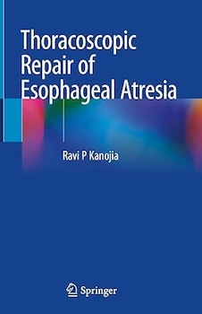 عکس Thoracoscopic Repair of Esophageal Atresia