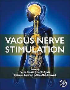 عکس Vagus Nerve Stimulation