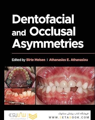 Dentofacial and Occlusal Asymmetries 1st Edition