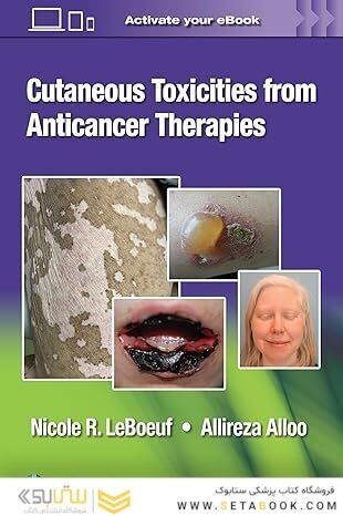 Cutaneous Toxicities from Anticancer Therapies