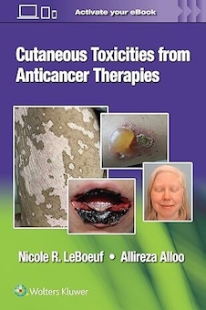 عکس Cutaneous Toxicities from Anticancer Therapies