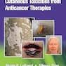 Cutaneous Toxicities from Anticancer Therapies