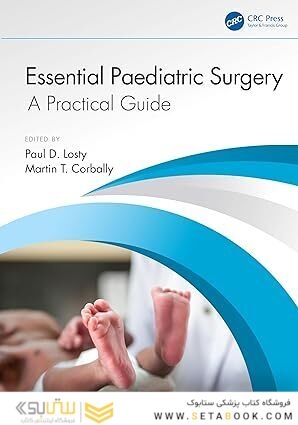 Essential Paediatric Surgery: A Practical Guide 1st Edition