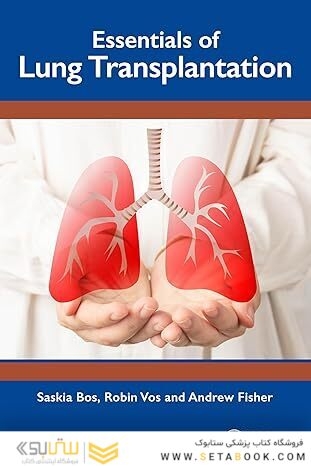 Essentials of Lung Transplantation