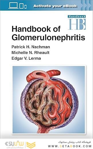 Handbook of Glomerulonephritis First Edition