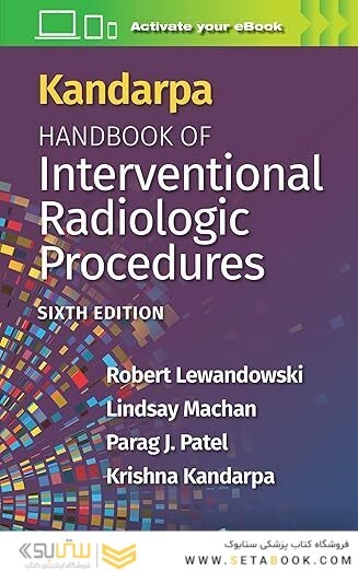 Kandarpa Handbook of Interventional Radiologic Procedures
