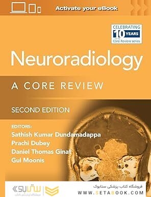Neuroradiology: A Core Review