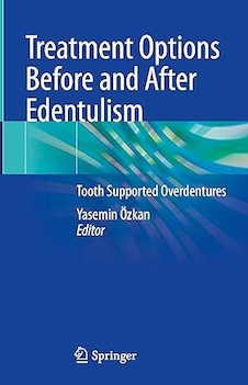 عکس Treatment Options Before and After Edentulism: Tooth Supported Overdentures 1st ed
