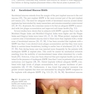 Peri-Implant Soft Tissue Management: A Clinical Guide