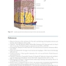 Peri-Implant Soft Tissue Management: A Clinical Guide