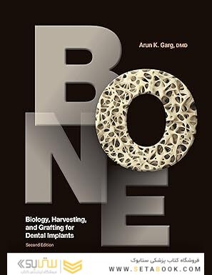 Bone: Biology, Harvesting, and Grafting for Dental Implants, 2nd Edition
