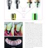 Implant Prosthodontics: Protocols and Techniques for Fixed Implant Restorations