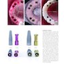 Implant Prosthodontics: Protocols and Techniques for Fixed Implant Restorations