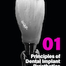 Implant Prosthodontics: Protocols and Techniques for Fixed Implant Restorations
