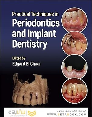 Practical Techniques in Periodontics and Implant Dentistry 1st Edition