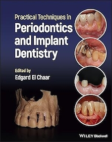 عکس Practical Techniques in Periodontics and Implant Dentistry 1st Edition