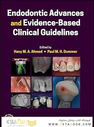 Endodontic Advances and Evidence-Based Clinical Guidelines 1st Edition