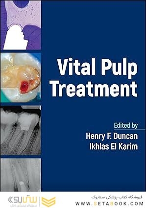Vital Pulp Treatment