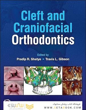 Cleft and Craniofacial Orthodontics 1st Edition